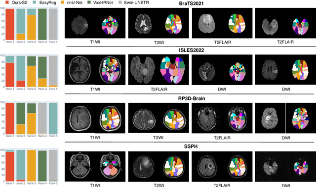 Figure 3 for AutoRG-Brain: Grounded Report Generation for Brain MRI
