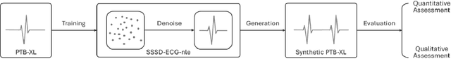 Figure 1 for SSSD-ECG-nle: New Label Embeddings with Structured State-Space Models for ECG generation