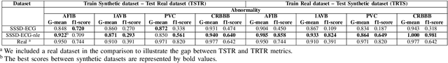Figure 4 for SSSD-ECG-nle: New Label Embeddings with Structured State-Space Models for ECG generation