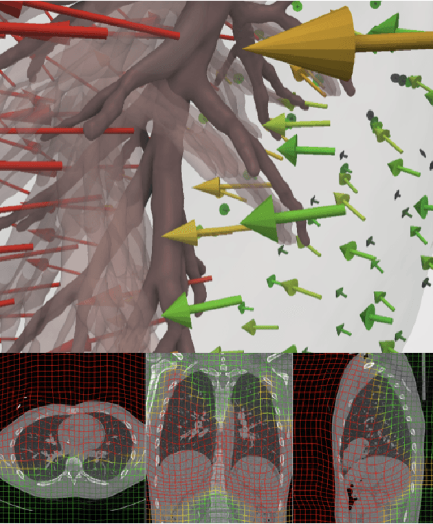 Figure 2 for A Dataset of Anatomical Environments for Medical Robots: Modeling Respiratory Deformation
