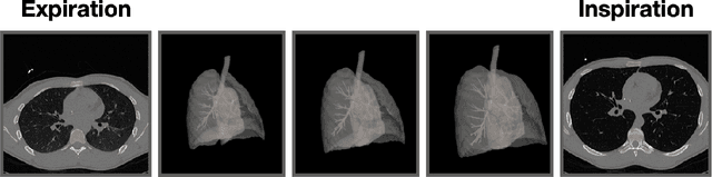 Figure 3 for A Dataset of Anatomical Environments for Medical Robots: Modeling Respiratory Deformation
