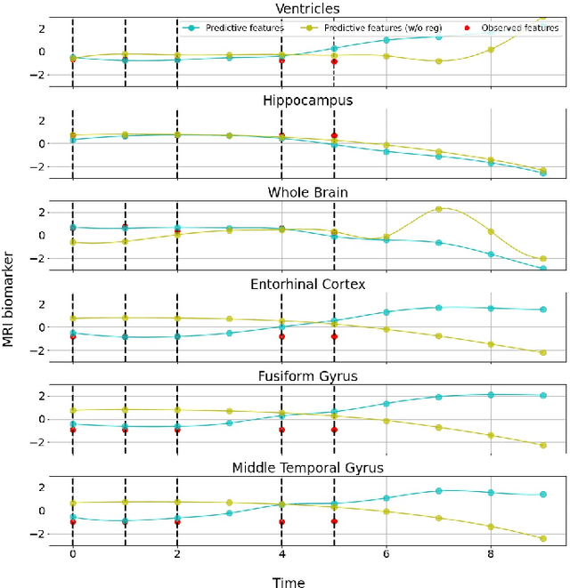 Figure 4 for Deep Geometric Learning with Monotonicity Constraints for Alzheimer's Disease Progression