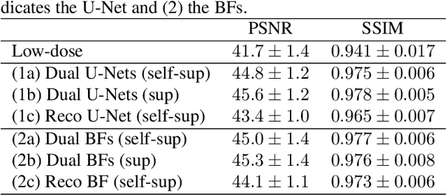 Figure 2 for On the Benefit of Dual-domain Denoising in a Self-supervised Low-dose CT Setting