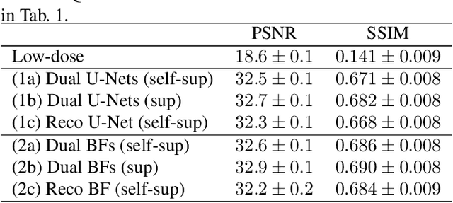 Figure 4 for On the Benefit of Dual-domain Denoising in a Self-supervised Low-dose CT Setting