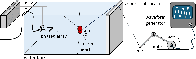 Figure 2 for Active Inference for Closed-loop transmit beamsteering in Fetal Doppler Ultrasound