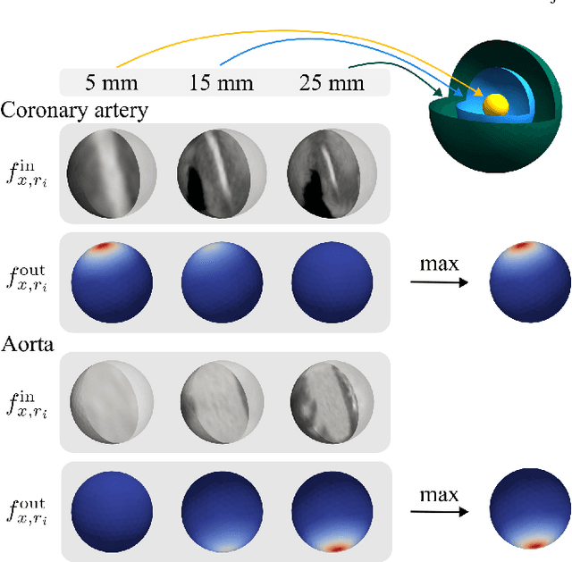 Figure 3 for SIRE: scale-invariant, rotation-equivariant estimation of artery orientations using graph neural networks