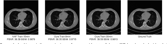 Figure 3 for Sparse-view CT Reconstruction with 3D Gaussian Volumetric Representation