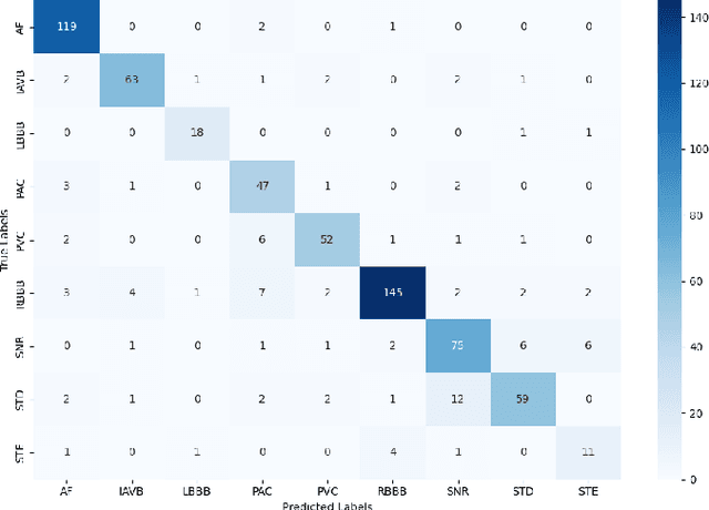 Figure 2 for A Lightweight CNN-Attention-BiLSTM Architecture for Multi-Class Arrhythmia Classification on Standard and Wearable ECGs