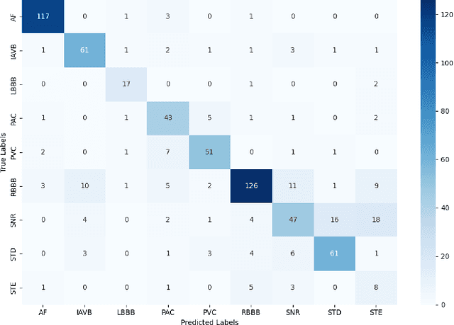 Figure 3 for A Lightweight CNN-Attention-BiLSTM Architecture for Multi-Class Arrhythmia Classification on Standard and Wearable ECGs