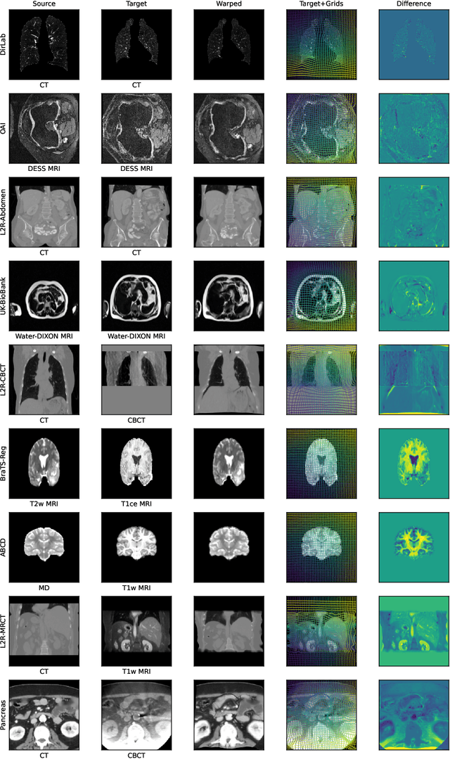 Figure 4 for multiGradICON: A Foundation Model for Multimodal Medical Image Registration
