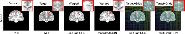 Figure 1 for multiGradICON: A Foundation Model for Multimodal Medical Image Registration