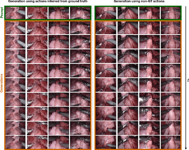 Figure 3 for Surgical Vision World Model