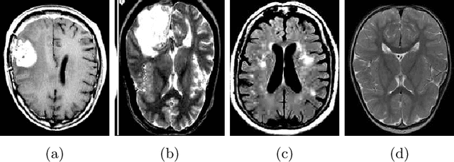 Figure 2 for Explainable Cost-Sensitive Deep Neural Networks for Brain Tumor Detection from Brain MRI Images considering Data Imbalance