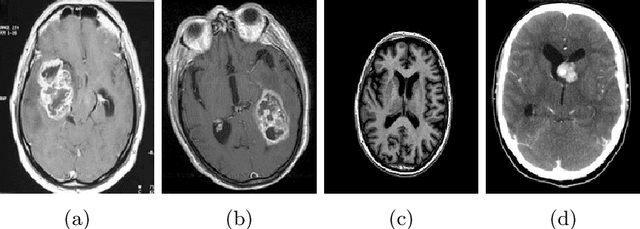Figure 4 for Explainable Cost-Sensitive Deep Neural Networks for Brain Tumor Detection from Brain MRI Images considering Data Imbalance