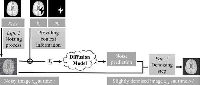 Figure 2 for Denoising Diffusion Models for Inpainting of Healthy Brain Tissue