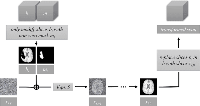 Figure 3 for Denoising Diffusion Models for Inpainting of Healthy Brain Tissue