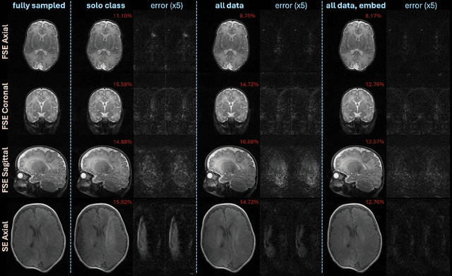 Figure 3 for Accelerated, Robust Lower-Field Neonatal MRI with Generative Models