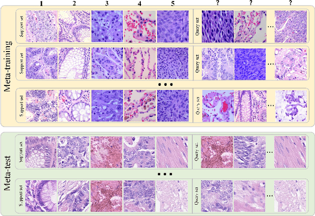 Figure 1 for Dual-channel Prototype Network for few-shot Classification of Pathological Images