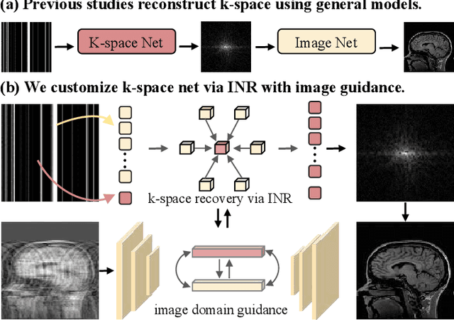 Figure 1 for Continuous K-space Recovery Network with Image Guidance for Fast MRI Reconstruction