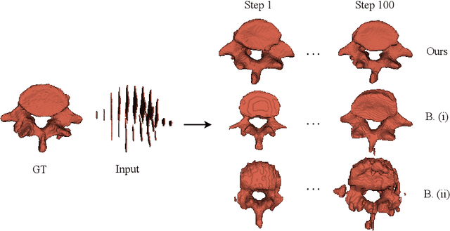Figure 1 for Fast Medical Shape Reconstruction via Meta-learned Implicit Neural Representations