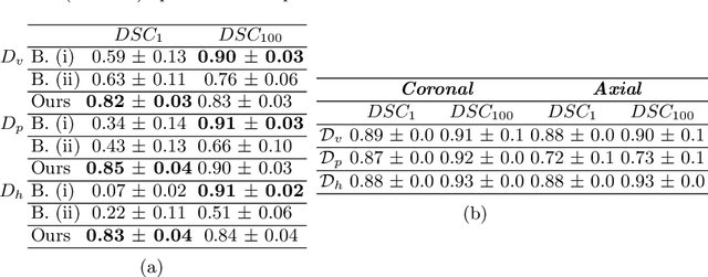 Figure 4 for Fast Medical Shape Reconstruction via Meta-learned Implicit Neural Representations