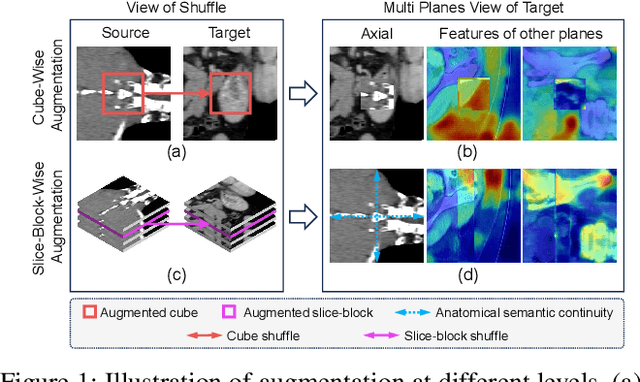 Figure 1 for JanusNet: Hierarchical Slice-Block Shuffle and Displacement for Semi-Supervised 3D Multi-Organ Segmentation