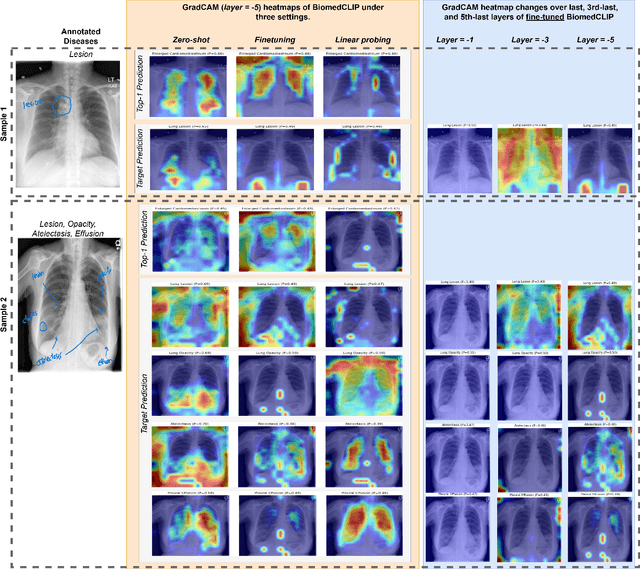 Figure 4 for Interpreting Biomedical VLMs on High-Imbalance Out-of-Distributions: An Insight into BiomedCLIP on Radiology
