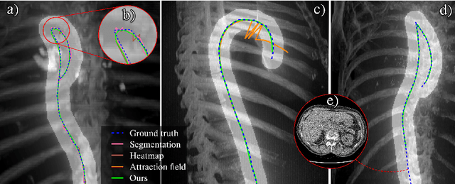 Figure 3 for Robust Curve Detection in Volumetric Medical Imaging via Attraction Field