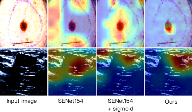 Figure 2 for Adapting a Segmentation Foundation Model for Medical Image Classification