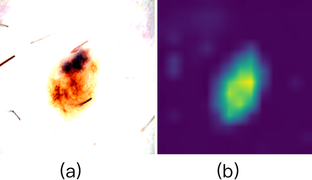Figure 3 for Adapting a Segmentation Foundation Model for Medical Image Classification