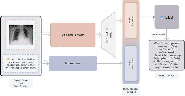 Figure 1 for Adapting Lightweight Vision Language Models for Radiological Visual Question Answering