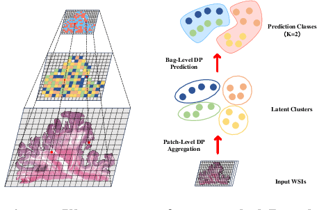 Figure 1 for cDP-MIL: Robust Multiple Instance Learning via Cascaded Dirichlet Process