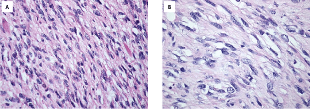 Figure 2 for Improving cognitive diagnostics in pathology: a deep learning approach for augmenting perceptional understanding of histopathology images