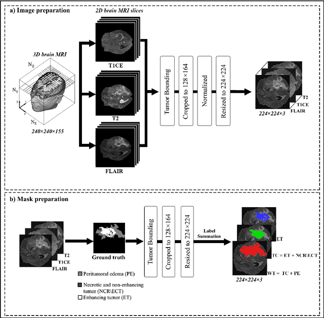 Figure 1 for Attention Xception UNet (AXUNet): A Novel Combination of CNN and Self-Attention for Brain Tumor Segmentation