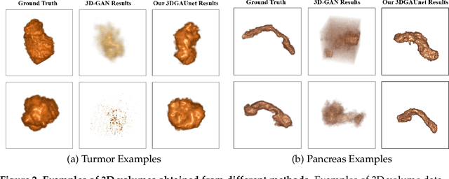 Figure 3 for 3DGAUnet: 3D generative adversarial networks with a 3D U-Net based generator to achieve the accurate and effective synthesis of clinical tumor image data for pancreatic cancer