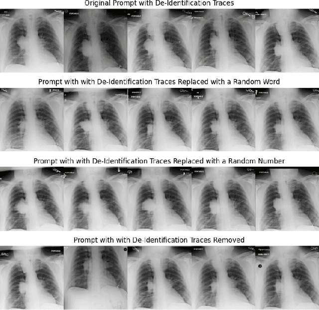Figure 3 for The Devil is in the Prompts: De-Identification Traces Enhance Memorization Risks in Synthetic Chest X-Ray Generation