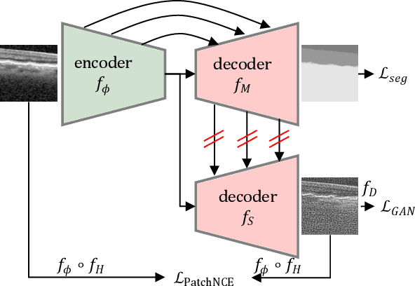 Figure 1 for Anatomical Conditioning for Contrastive Unpaired Image-to-Image Translation of Optical Coherence Tomography Images