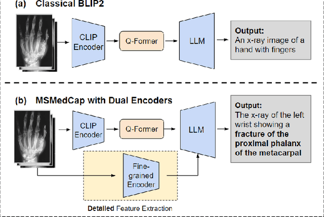 Figure 1 for Sam-Guided Enhanced Fine-Grained Encoding with Mixed Semantic Learning for Medical Image Captioning