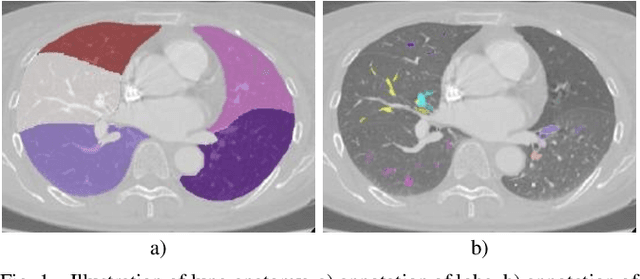 Figure 1 for Bronchovascular Tree-Guided Weakly Supervised Learning Method for Pulmonary Segment Segmentation