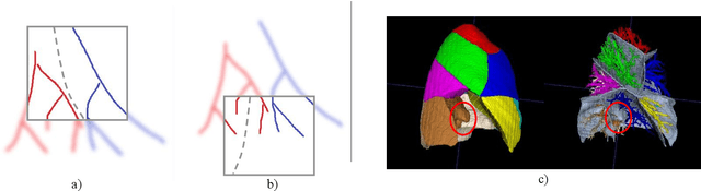 Figure 2 for Bronchovascular Tree-Guided Weakly Supervised Learning Method for Pulmonary Segment Segmentation
