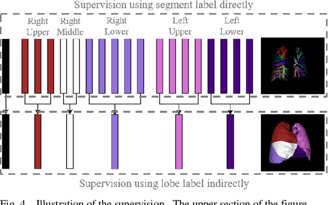 Figure 4 for Bronchovascular Tree-Guided Weakly Supervised Learning Method for Pulmonary Segment Segmentation
