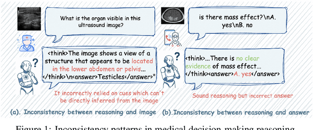 Figure 1 for CAPO: Reinforcing Consistent Reasoning in Medical Decision-Making