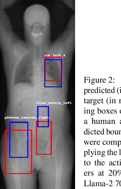 Figure 3 for Automatic Mapping of Anatomical Landmarks from Free-Text Using Large Language Models: Insights from Llama-2