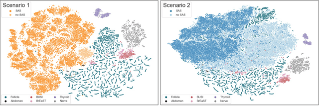Figure 4 for SAS: Segment Anything Small for Ultrasound -- A Non-Generative Data Augmentation Technique for Robust Deep Learning in Ultrasound Imaging