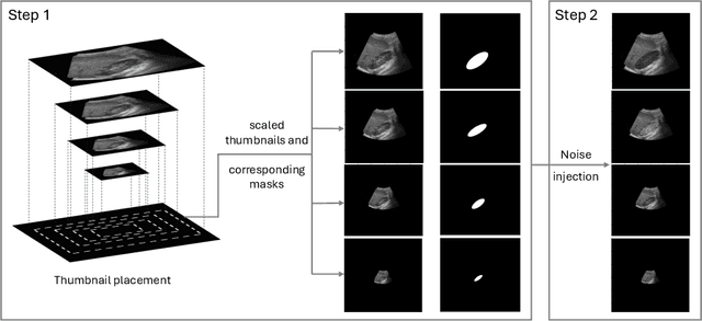 Figure 1 for SAS: Segment Anything Small for Ultrasound -- A Non-Generative Data Augmentation Technique for Robust Deep Learning in Ultrasound Imaging