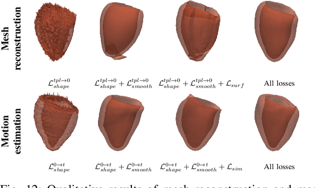 Figure 4 for DeepMesh: Mesh-based Cardiac Motion Tracking using Deep Learning