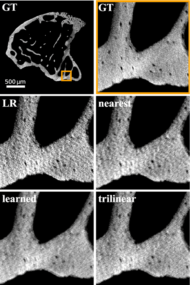 Figure 3 for Geometric Constraints Enable Self-Supervised Sinogram Inpainting in Sparse-View Tomography