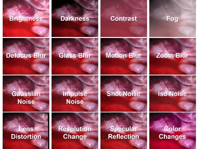 Figure 1 for EndoDepth: A Benchmark for Assessing Robustness in Endoscopic Depth Prediction