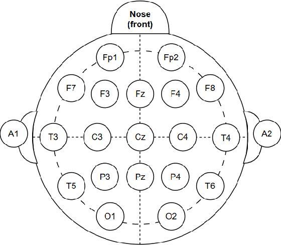 Figure 1 for Enhancing Alzheimer's Detection through Late Fusion of Multi-Modal EEG Features