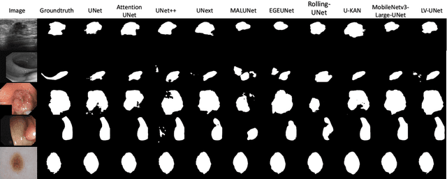 Figure 3 for LV-UNet: A Lightweight and Vanilla Model for Medical Image Segmentation